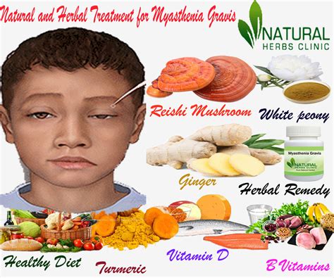 Myasthenia Gravis Archives - Natural Herbs Clinic - Blog