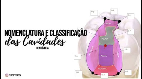 Classificação e Nomenclatura das Cavidades YouTube