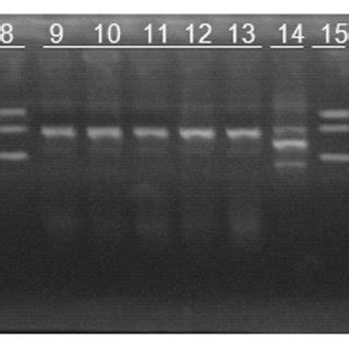 Electroforesis Del Gel De Agarosa Al Te Ido Con Bromuro De Etidio