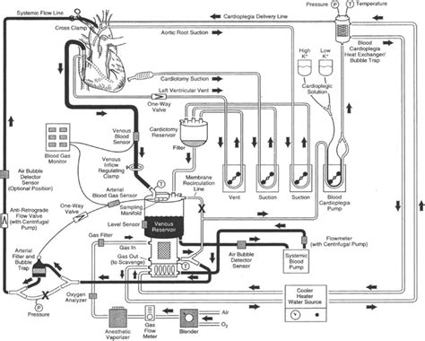 Cardiopulmonary Bypass Diagram