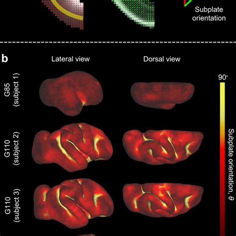 Cortical folding and subcortical organization a–b Magnetic resonance ...