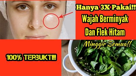 Cara Menghilangkan Kulit Berminyak Diwajah Dan Flek Hitam Diwajah L