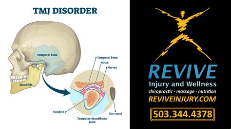 TMJ Jaw Pain Relief | Chiropractic Care Help With TMJ Jaw Pain