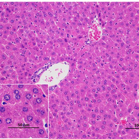 The Photomicrographs Of Liver Sections Stained By Hematoxylin Eosin