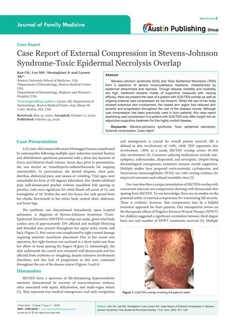 Austin Publishing Group Case Report Of External Compression In Stevens