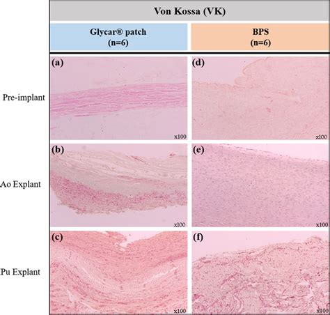 Representative Von Kossa Vk Histological Stain Of The Pre Implanted