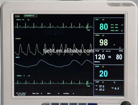 12 Inch Icu Ccu 6 Parameter Patient Monitor Nibp Spo2 Ecg Temp Resp Pr