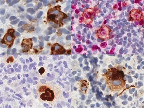 Ebv Chl Left Upper Cd Cytoplasmic Golgi And Membranous