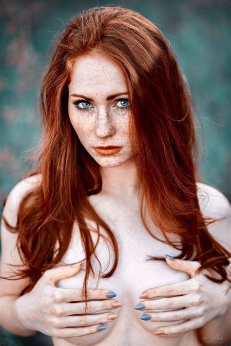 Kissed By Fire