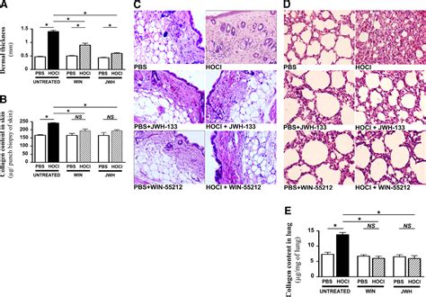 Targeting The Cannabinoid Pathway Limits The Development Of Fibrosis