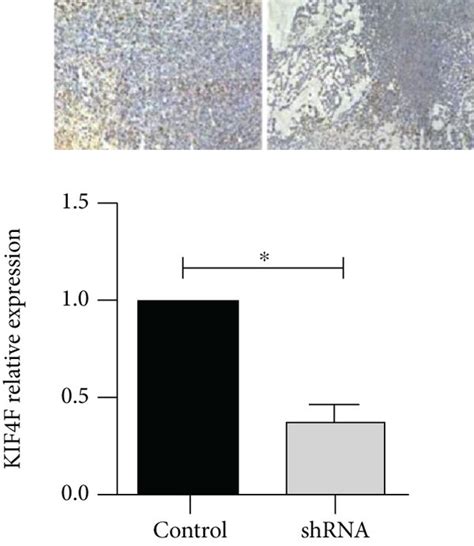 In Vivo Kif A Knockdown Inhibits Tumor Growth A B Tumor Volume In