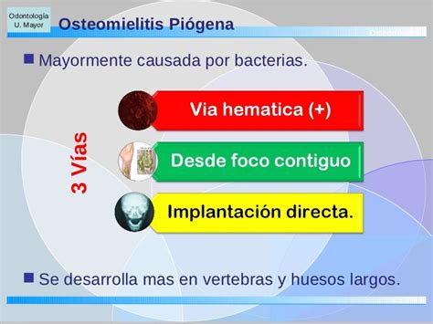 Osteomielitis