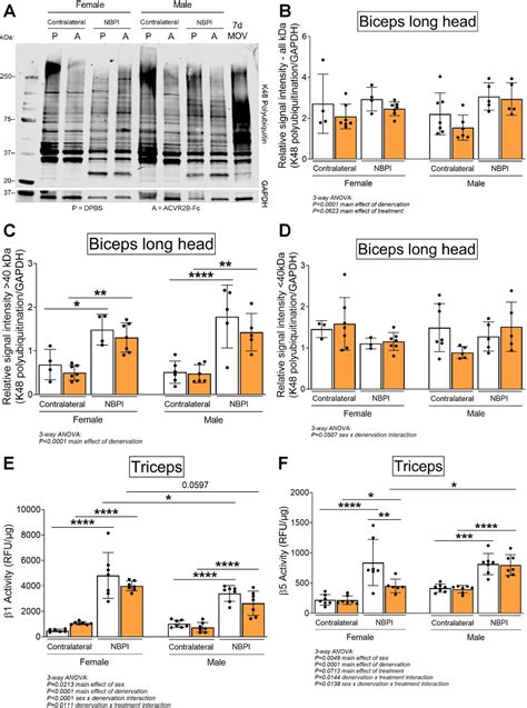 Sex Specific Role Of Myostatin Signaling In Neonatal Muscle Growth