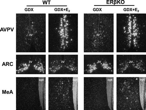 Representative Images Of Kiss1 MRNA Expression In The AVPV Female