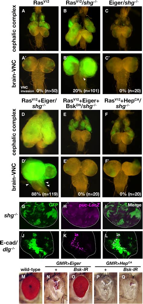 Loss Of Cell Polarity Drives Tumor Growth And Invasion Through Jnk Activation In Drosophila