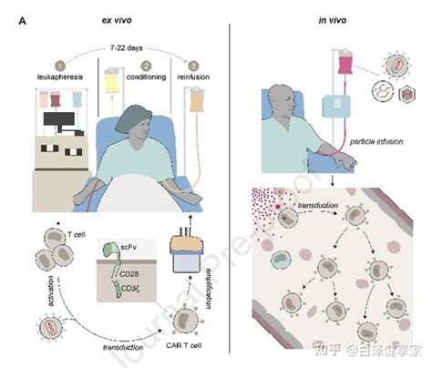 超详细盘点一文读懂体内 CAR T 疗法最新载体技术 知乎