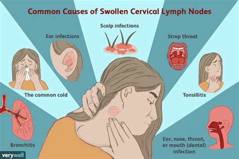 Enlarged Cervical Lymph Nodes