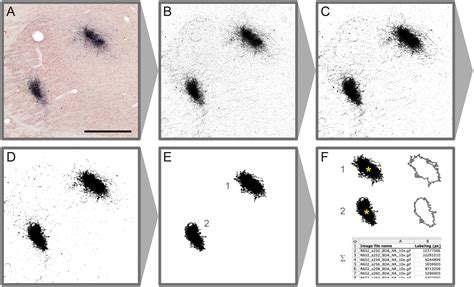 Frontiers Brain Wide Mapping Of Axonal Connections Workflow For