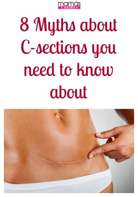 8 Myths About C Sections You Need To Know About C Section Cesarean