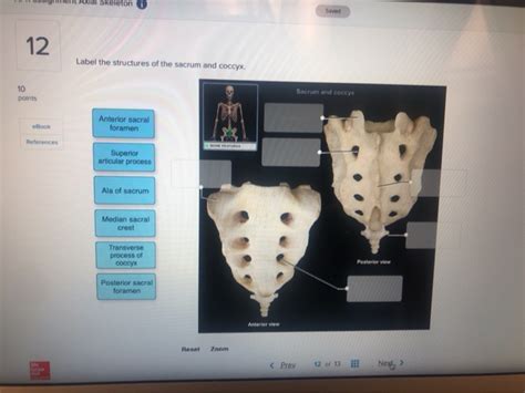 Solved Xial Skeleton Saved Label The Structures Of The Chegg