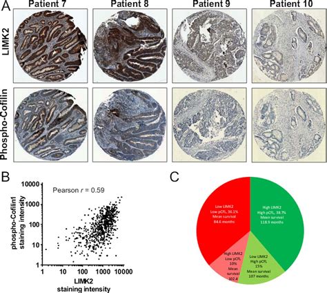 Association Of Lim Kinase 2 Limk2 Expression And Cofilin