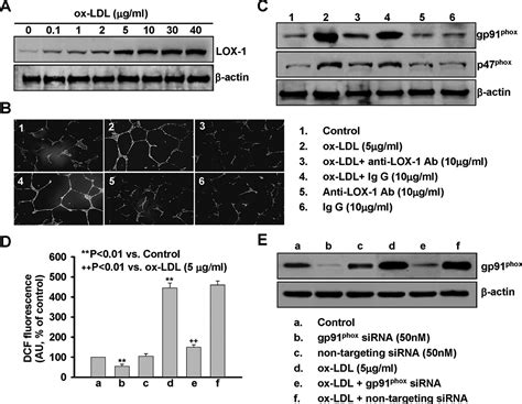 Small Concentrations Of Oxldl Induce Capillary Tube Formation From