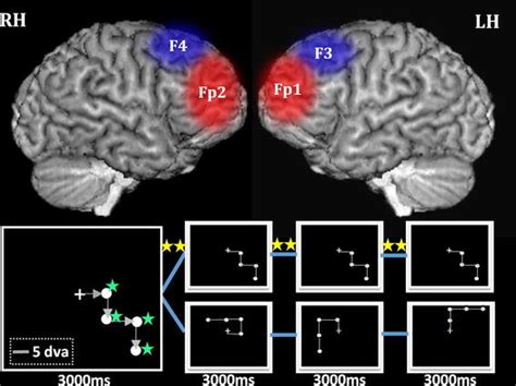 Image Depicting Stimulation Sites Of TMS On Dorsolateral Prefrontal