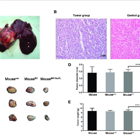 The Double Gene Expression Vector Can Inhibit Tumor Growth In Liver