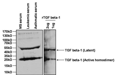 Anti-TGF beta-1 Antibodies | Invitrogen