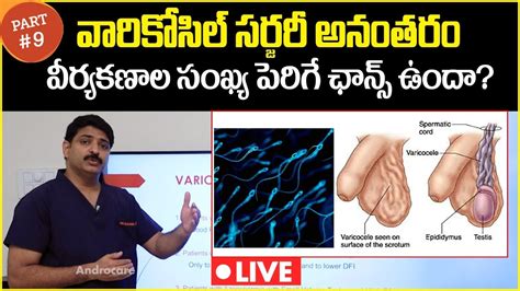 Can Sperm Count Increase After Varicocele Surgery Dr Rahul Reddy