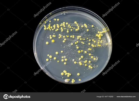 Bacterias Cultivadas Partir Frotis Cut Neo Colonias Micrococcus Luteus