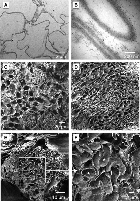 Ultrastructural Analysis Of The Acellular Bioscaffold A B