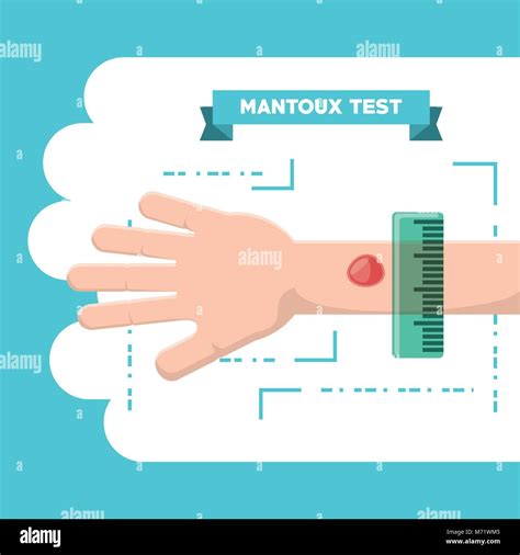 Mantoux Test Hi Res Stock Photography And Images Alamy