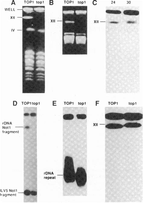 Figure From The Rrna Encoding Dna Array Has An Altered Structure In