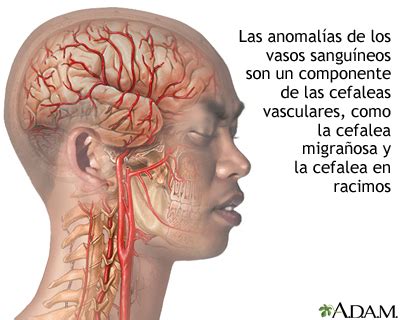 alarma Baño adiós que son las migrañas y porque se producen Mar gráfico