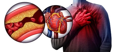 Early Stage Blood Clots Symptoms In The Heart | Dr. Raghu