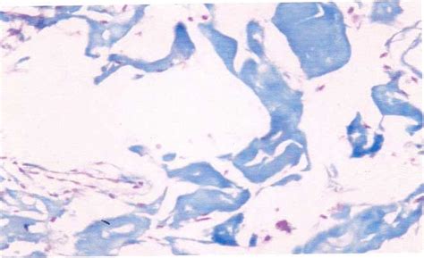 Alcian Blue Staining For Hyaline 40x Download Scientific Diagram