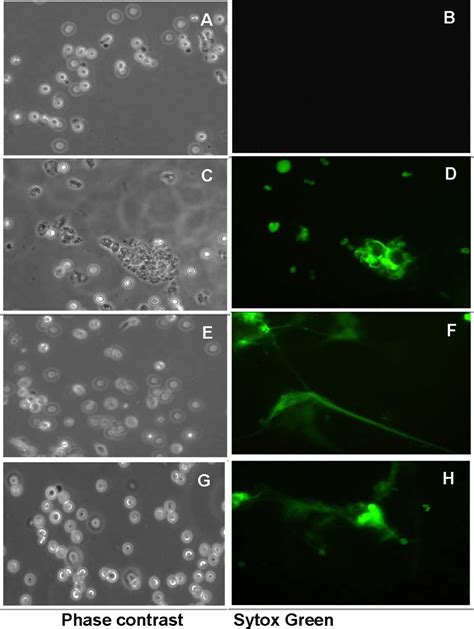 Induction of neutrophil extracellular traps by different concentrations ...