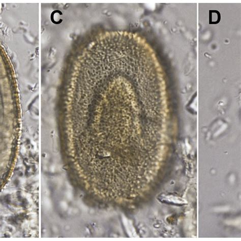 Helminth Eggs From Moa Coprolites A Egg Type Cf Heterakoidea