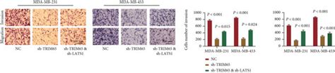 TRIM65 Promotes The Malignant Biological Behavior By Degrading The