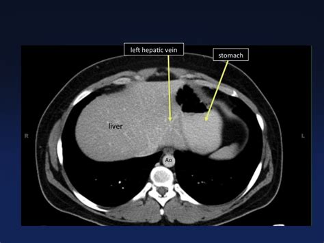 Cross Sectional Anatomy Of The Body Mdct Atlas Ct Scanning