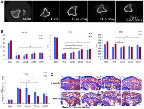 Chlorogenic Acid Prevents Ovariectomized Induced Bone Loss By