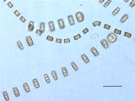 Multimedia Gallery The Chain Forming Diatom Thalassiosira Seen Under A Microscope It S A