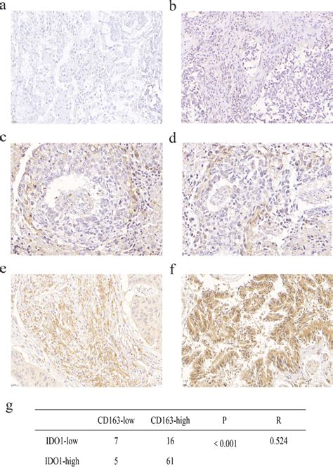 Association Of IDO1 Expression With M2 Macrophages And The