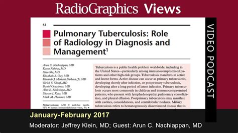 Pulmonary Tuberculosis Role Of Radiology In Diagnosis And Management