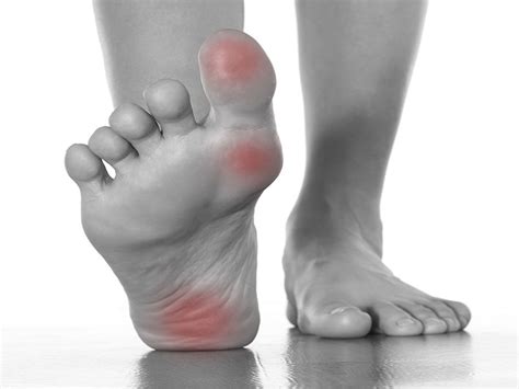 Top 9 Home Remedies for Foot Pain That Really Work