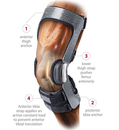 Donjoy Armor Knee Support Brace With Fourcepoint Hinge