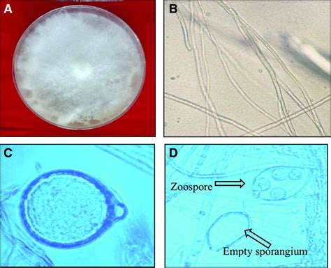 Morphological Identification Microscopic View Of Papillate Sporangia