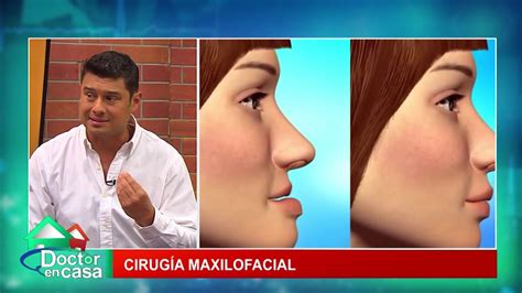 Cirugía Maxilofacial YouTube