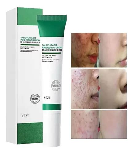 Ácido Salicílico Para Cravos - .creme Remoção Cravos Espinhas Acne Ácido Salicílico 20g | MercadoLivre